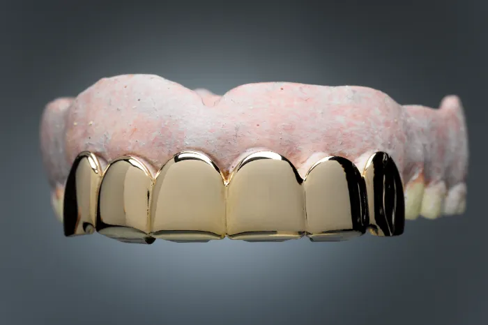 Gold Grillz Options For Different Tooth Alignments in Columbus, GA Gold Grillz Options For Different Tooth Alignments in Columbus, GA