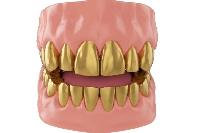 The Step By Step Process Of Making Gold Grillz Columbus, GA The Step By Step Process Of Making Gold Grillz Columbus, GA